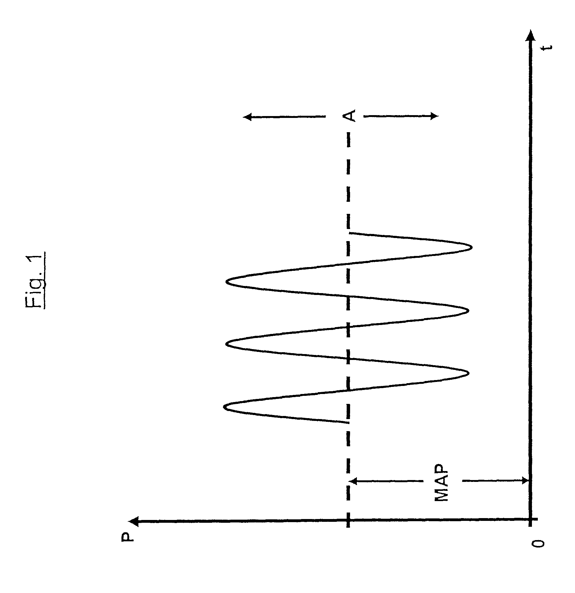 Device and method for respirating a patient by means of high-frequency ventilation