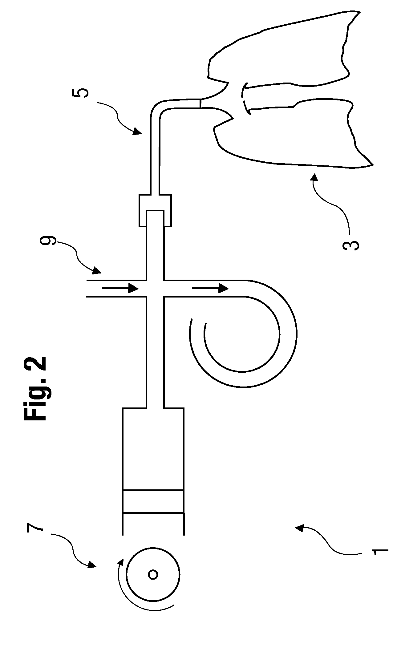 Device and method for respirating a patient by means of high-frequency ventilation