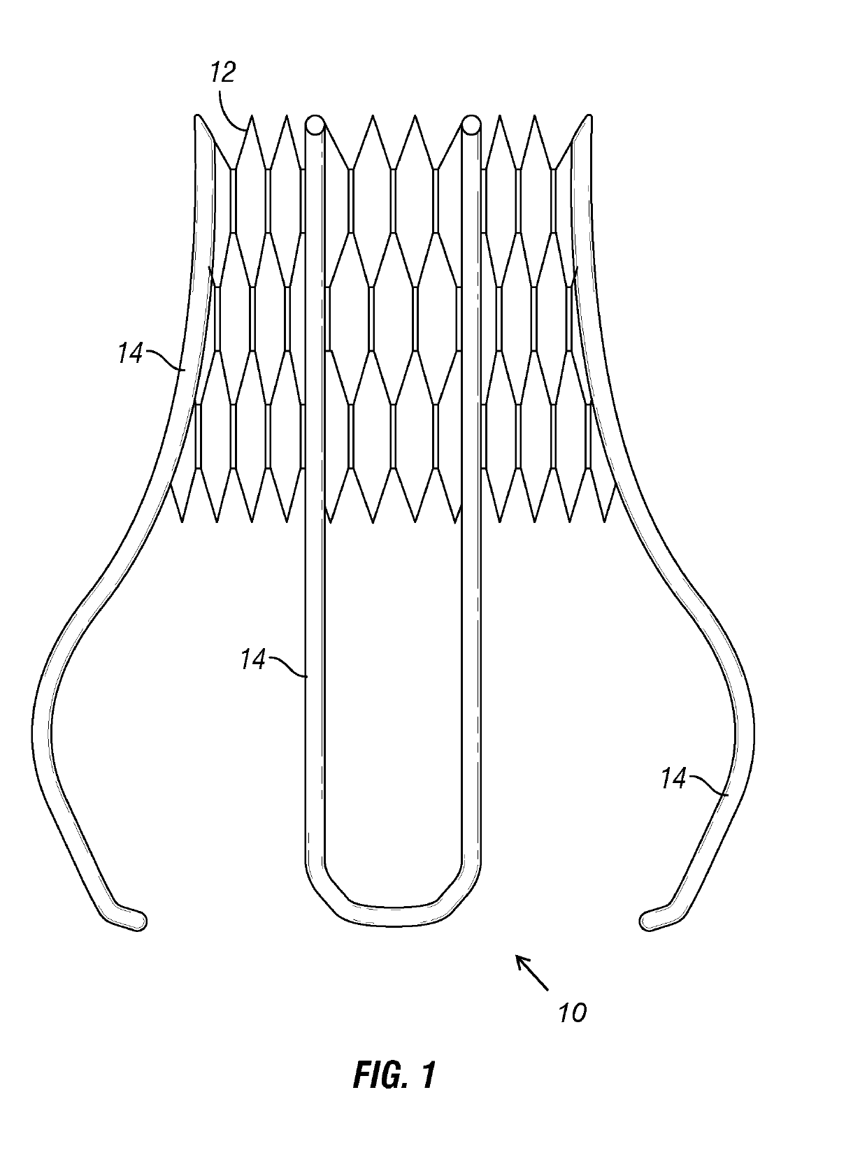 Docking Device for Aortic Valve Replacement