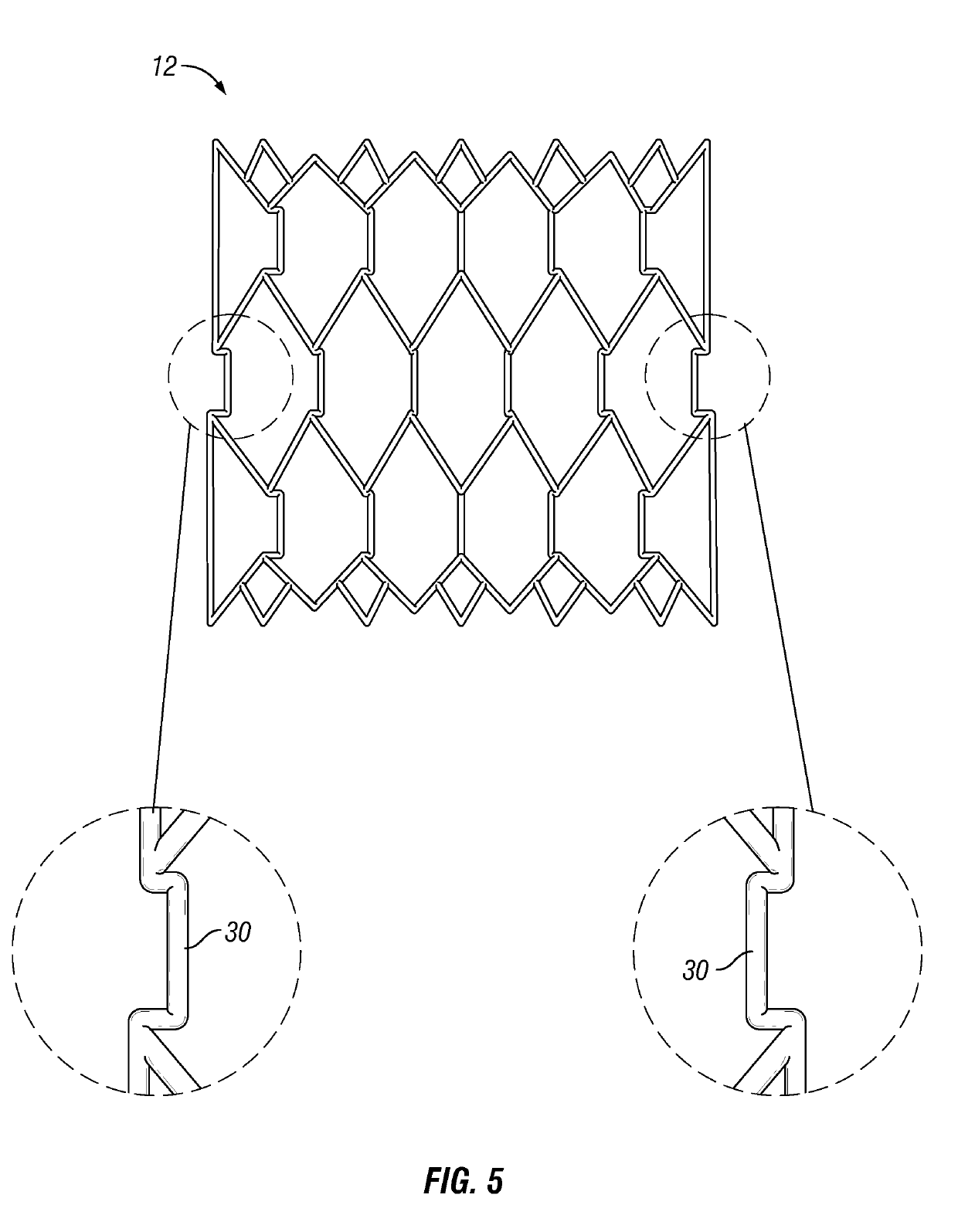 Docking Device for Aortic Valve Replacement