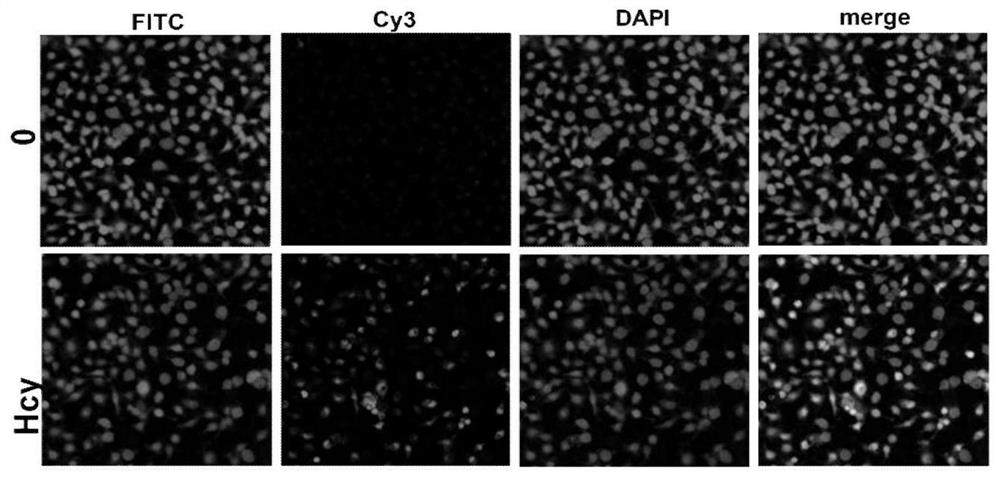 miRNA marker for diagnosing cardiovascular diseases and application of miRNA marker