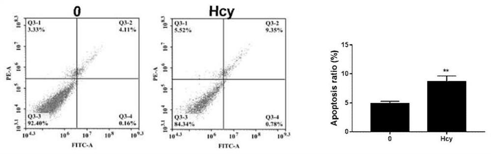 miRNA marker for diagnosing cardiovascular diseases and application of miRNA marker