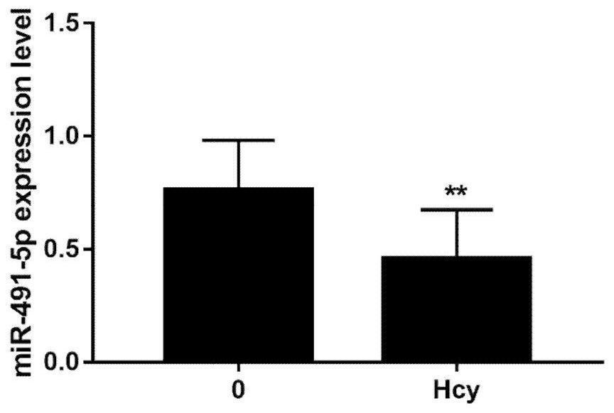 miRNA marker for diagnosing cardiovascular diseases and application of miRNA marker