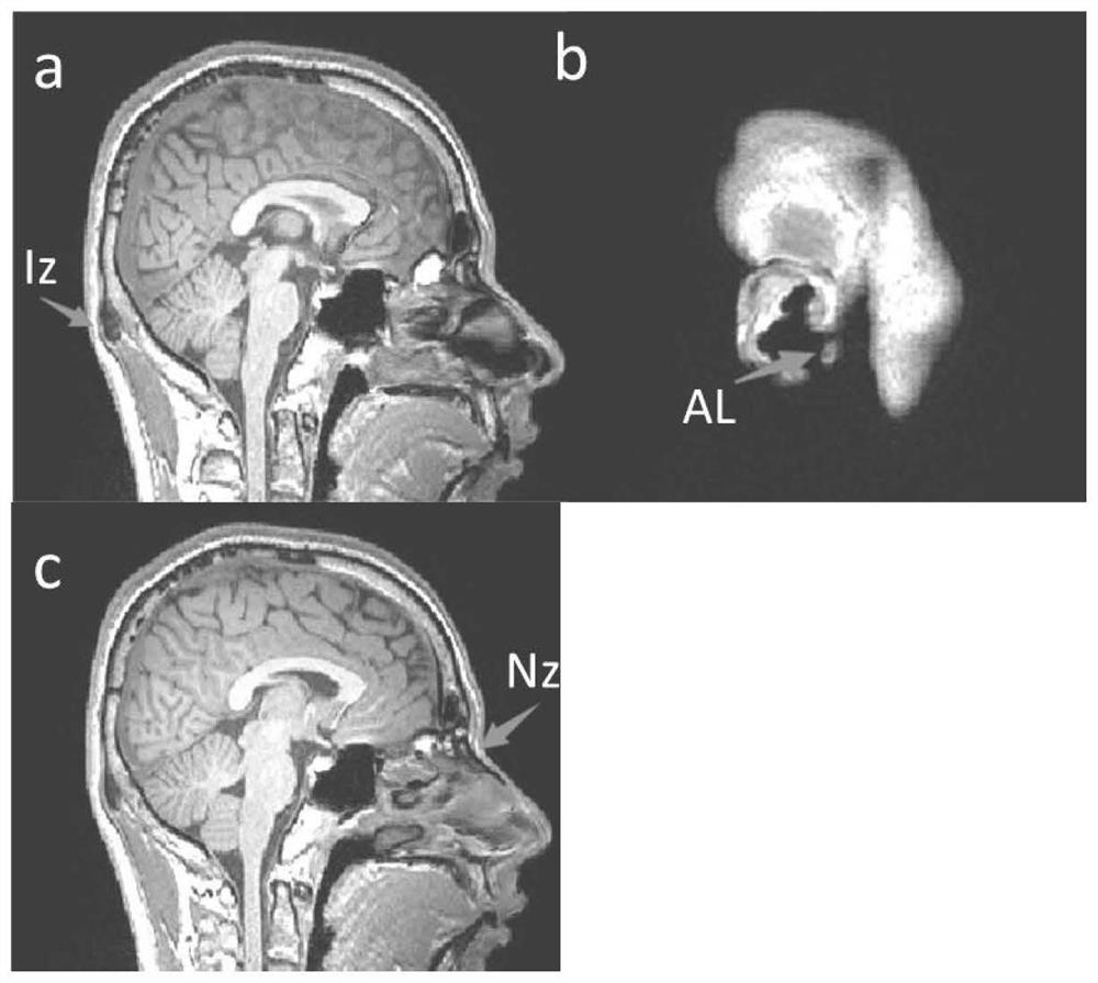 Transcranial brain map navigation method and system based on individual characteristics