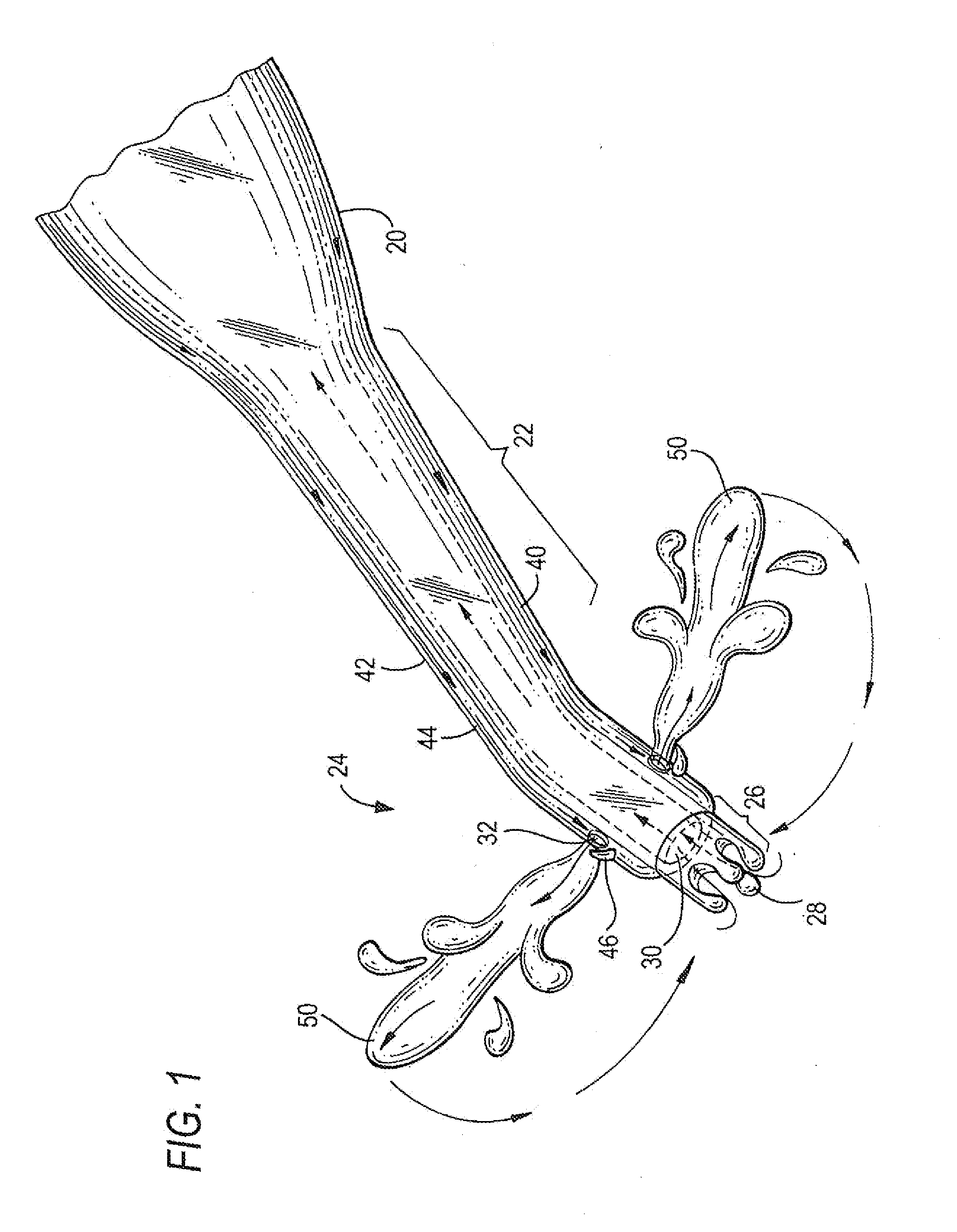 Apparatus and method for performing phacoemulsification
