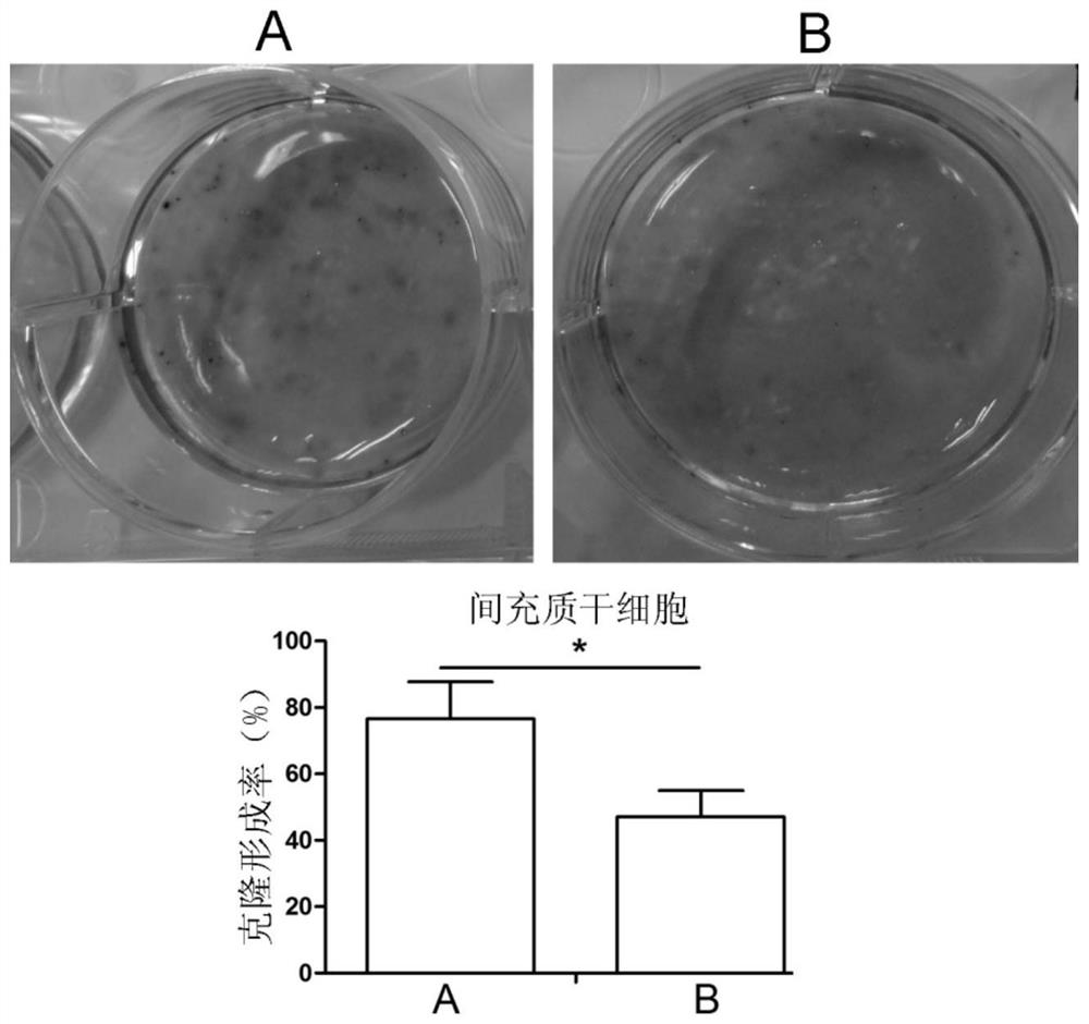 Serum-free culture medium capable of amplifying mesenchymal stem cells and preparation method thereof