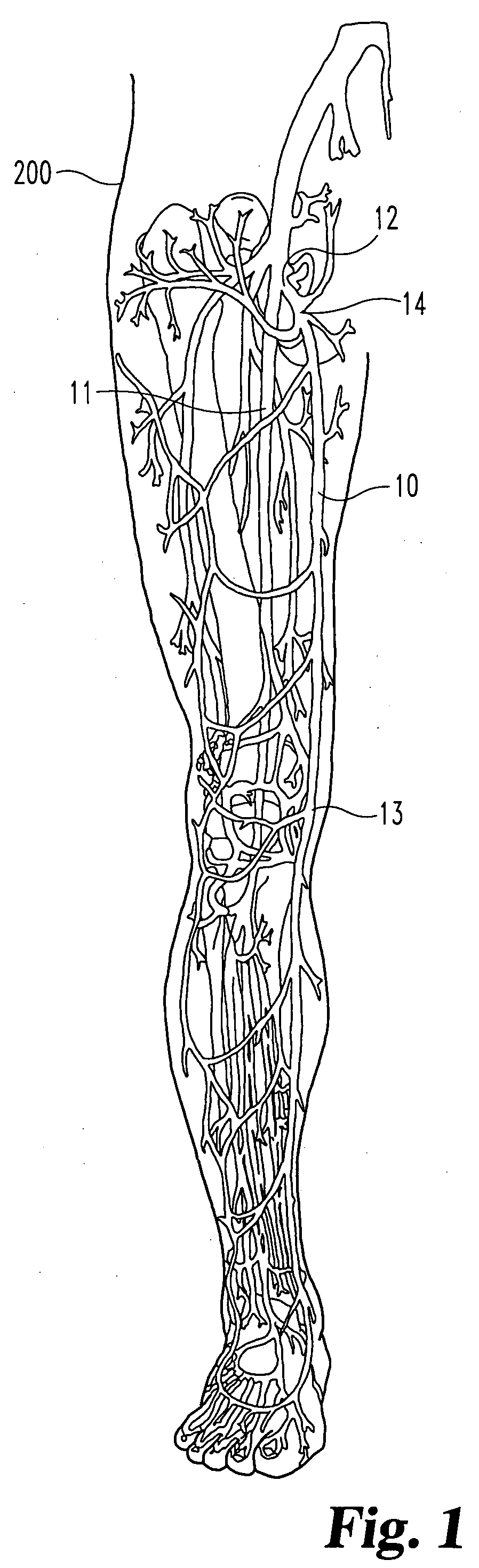 Inflatable occlusion devices, methods, and systems