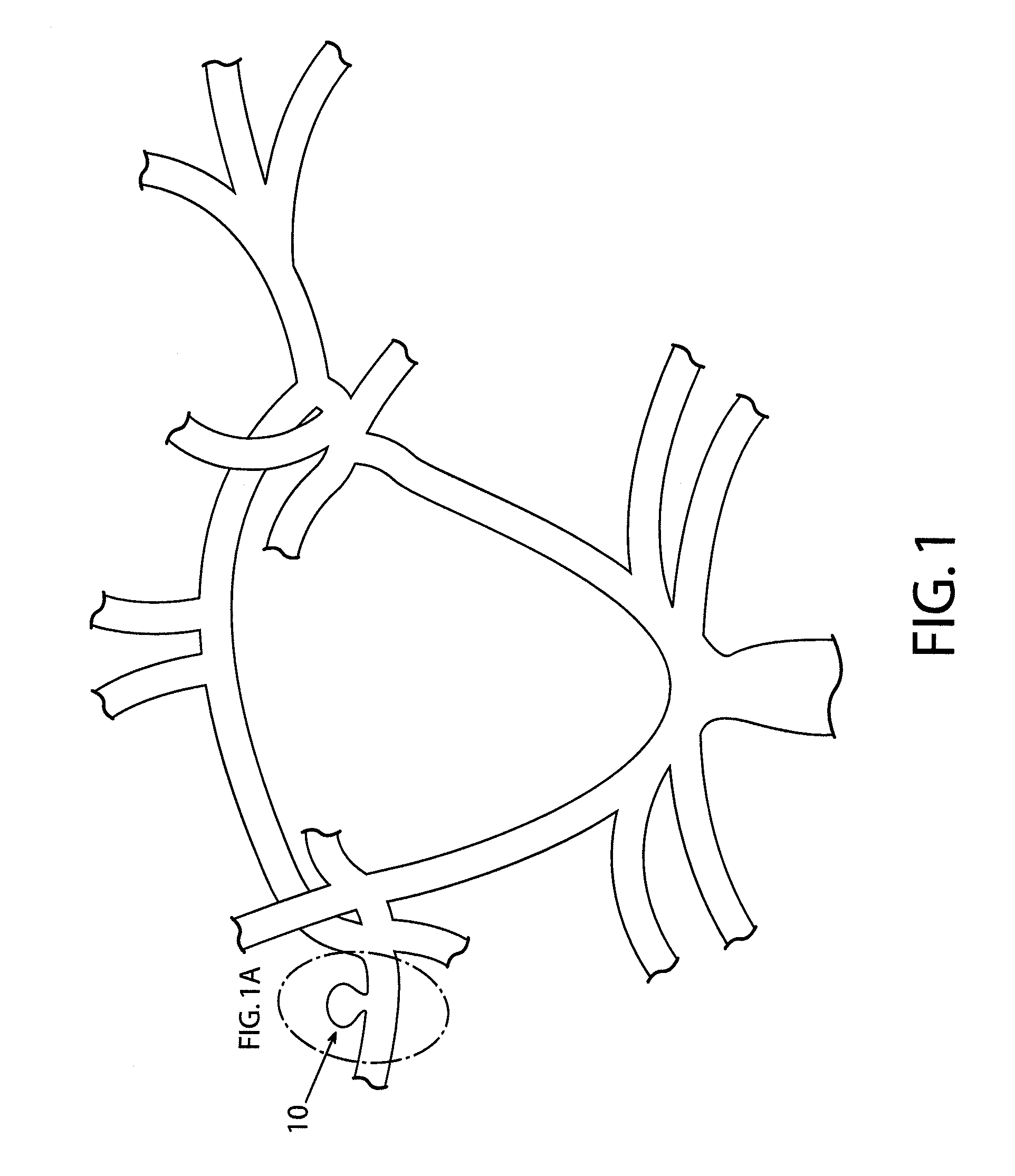 Devices and methods for occluding vascular abnormalities