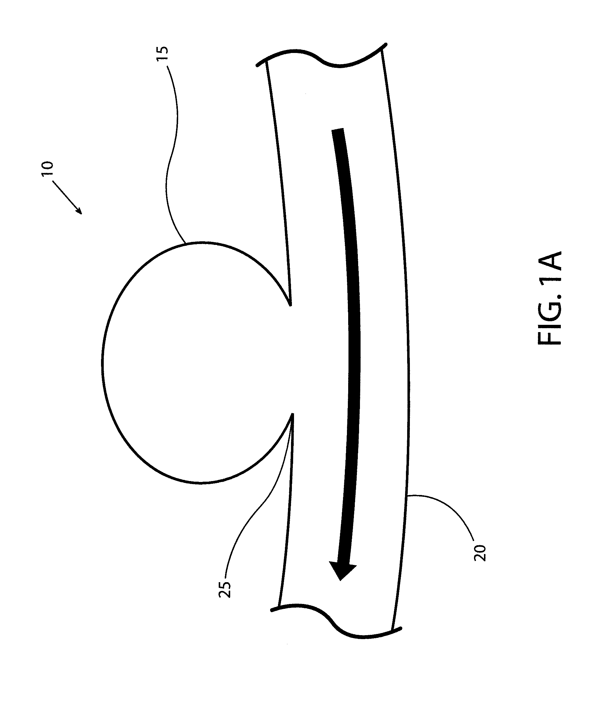 Devices and methods for occluding vascular abnormalities