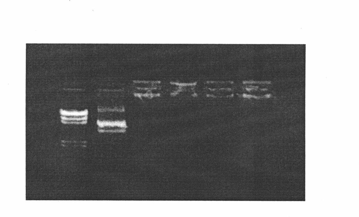 Recomposed tPA gene-chitosan nanoparticle complex and preparation method thereof