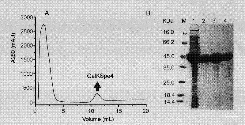 Application of galactokinase in synthesizing N-acetylgalactose-1-phosphoric acid and derivatives thereof