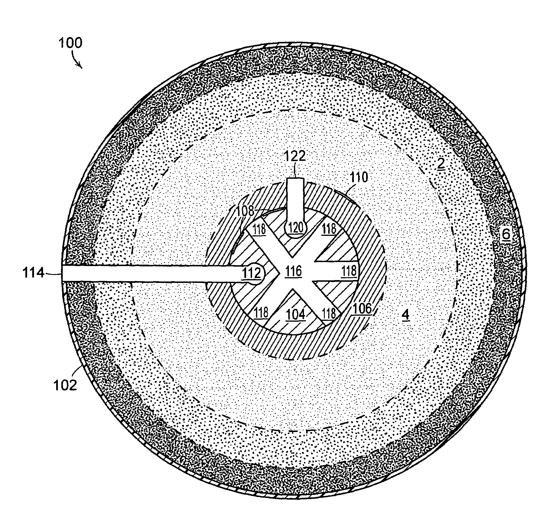 Processing bag for component separator system and method of removing separated components