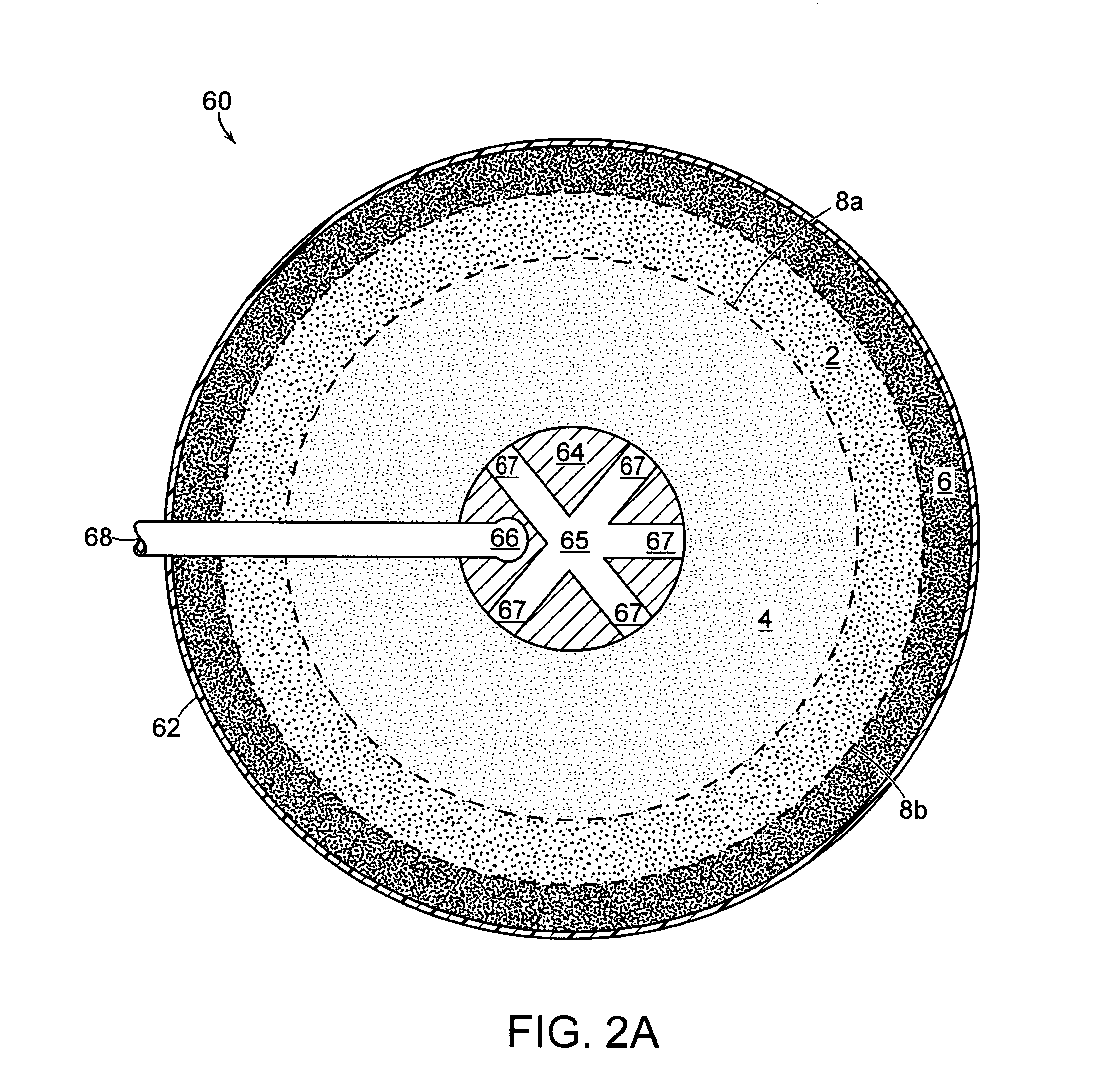 Processing bag for component separator system and method of removing separated components