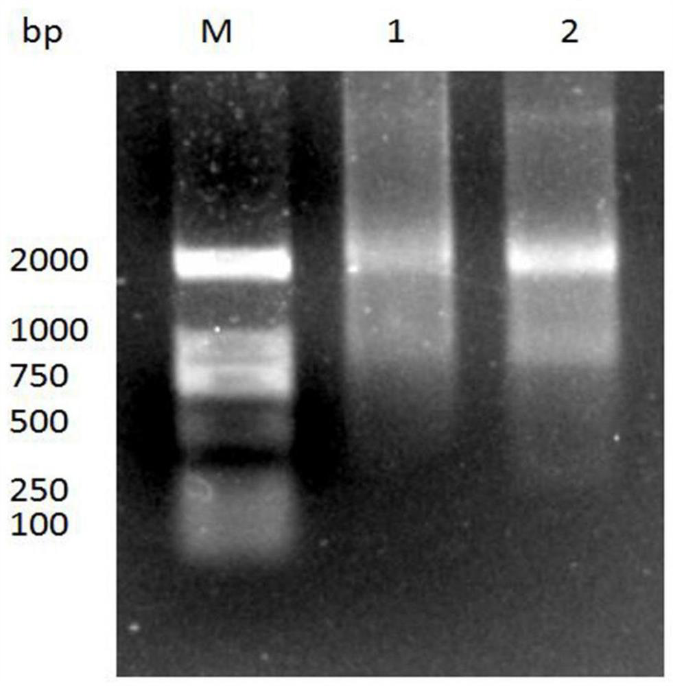 A kind of anti-afp nanobody 2f5 and its application