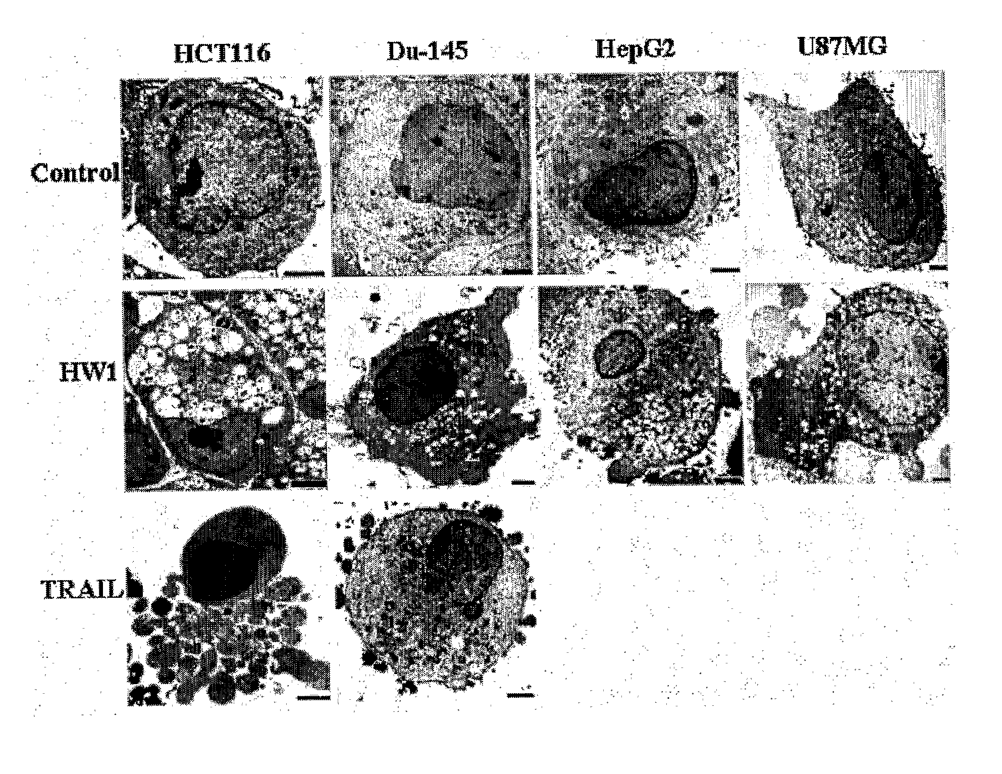 Antibody specifically binding to dr5 and composition for preventing or treating cancers comprising the same