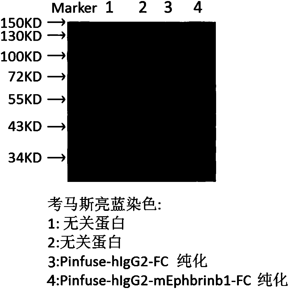 Use of Ephrin-B1 in preparation of drug for treating inflammatory bowel disease