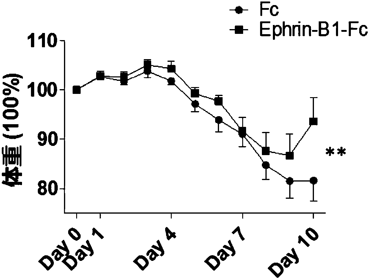 Use of Ephrin-B1 in preparation of drug for treating inflammatory bowel disease