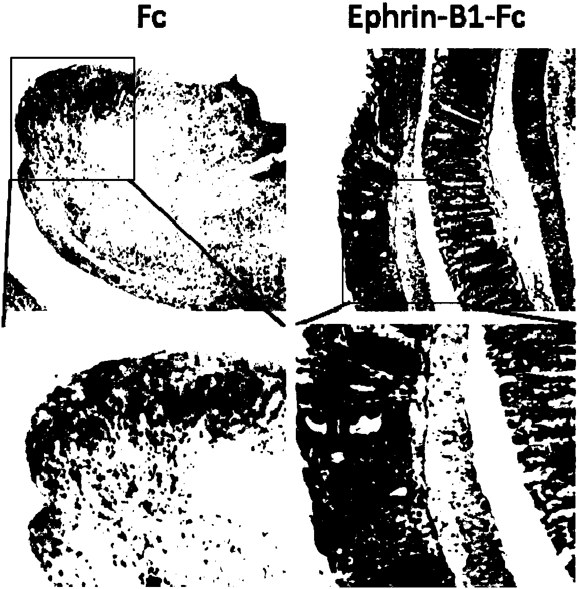 Use of Ephrin-B1 in preparation of drug for treating inflammatory bowel disease