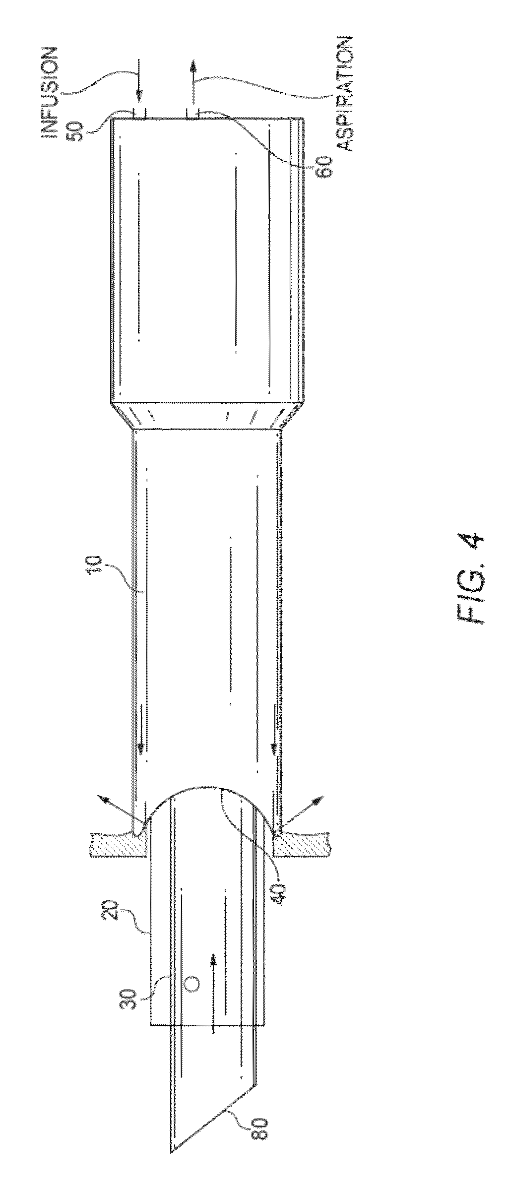 Multi-sleeved surgical ultrasonic vibrating tool suited for phacoemulsification in a manner that prevents thermal injury to ocular tissue