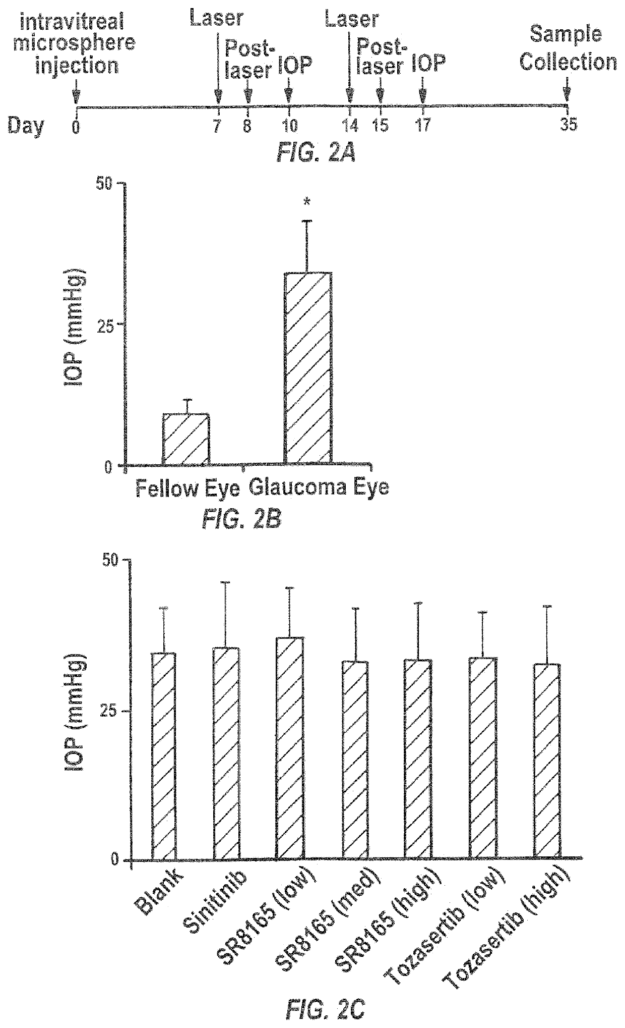 Sunitinib formulations and methods for use thereof in treatment of glaucoma