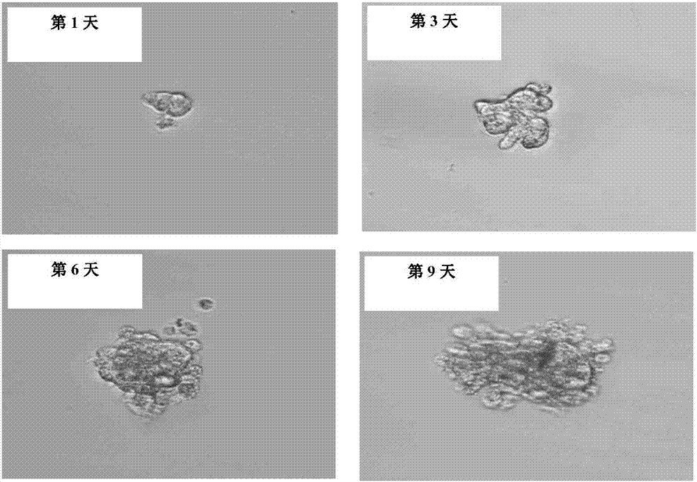 Serum-free tumor stem cell culture medium and application thereof