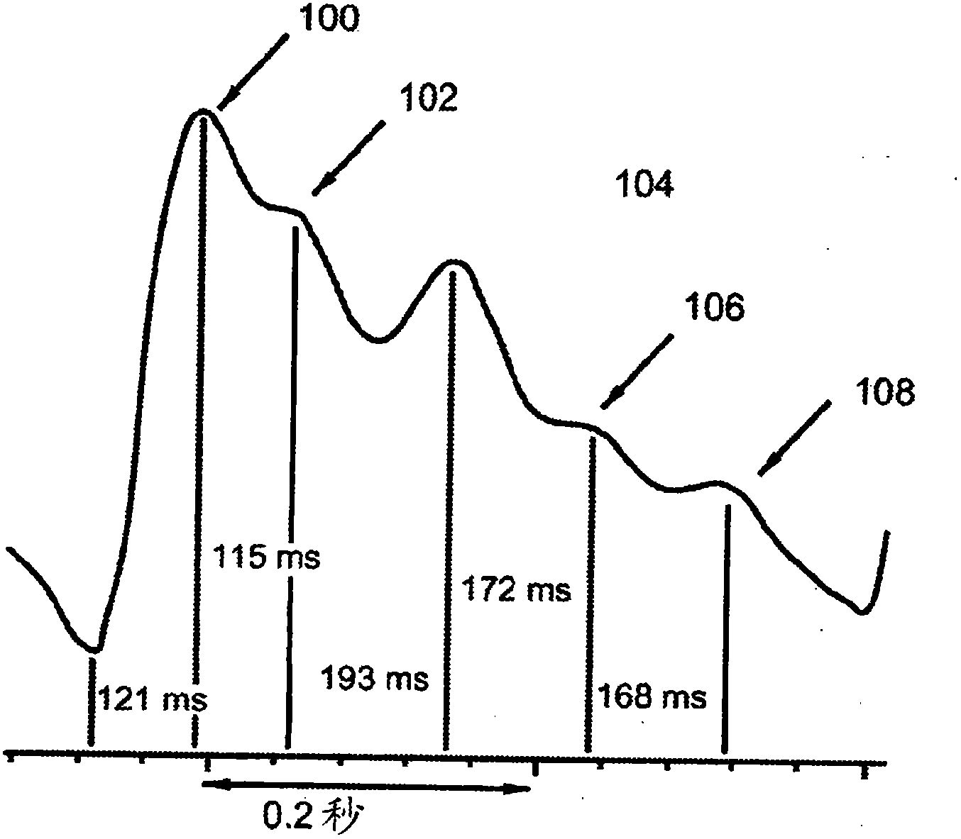 Diagnostic support apparatus