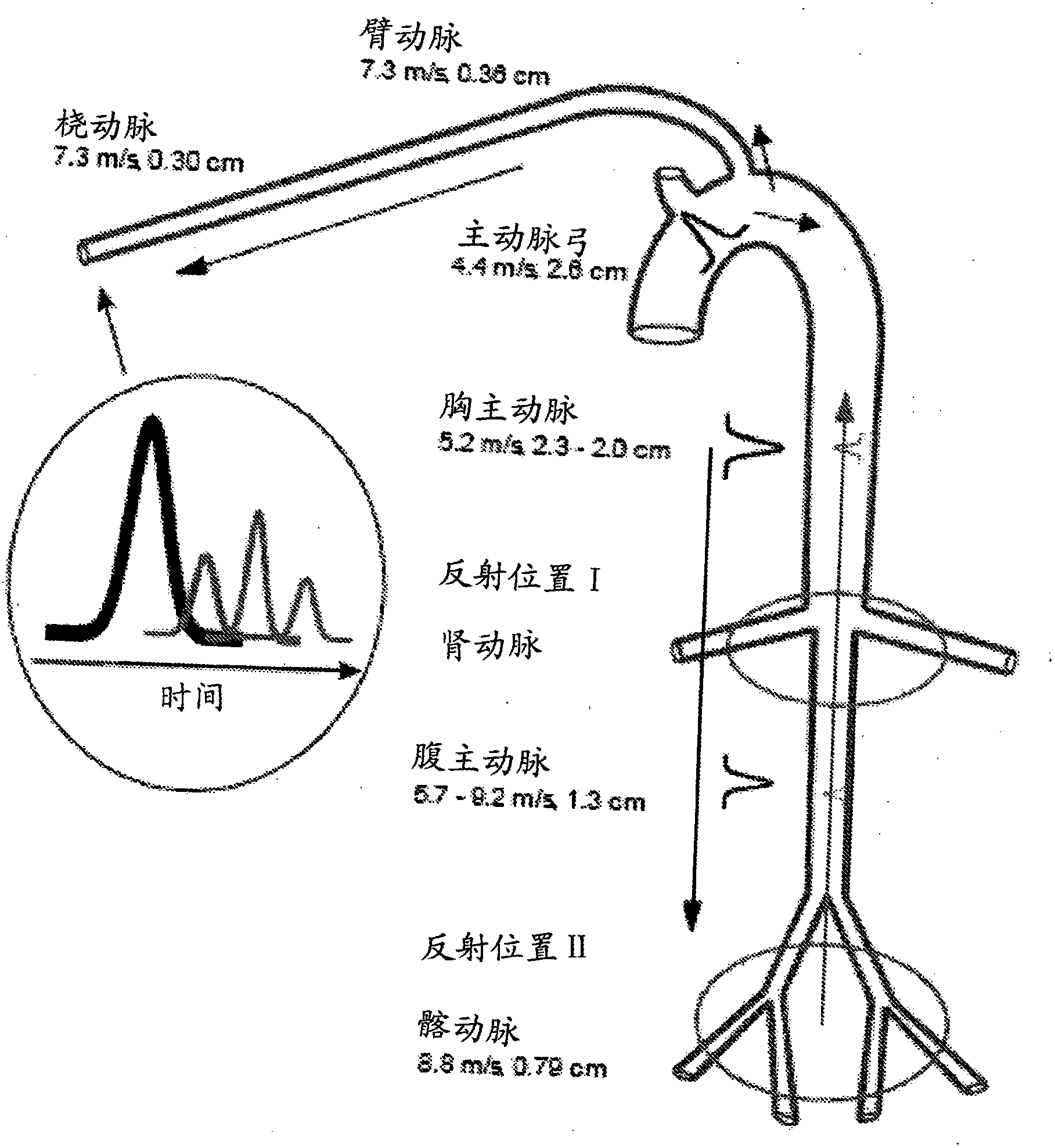 Diagnostic support apparatus