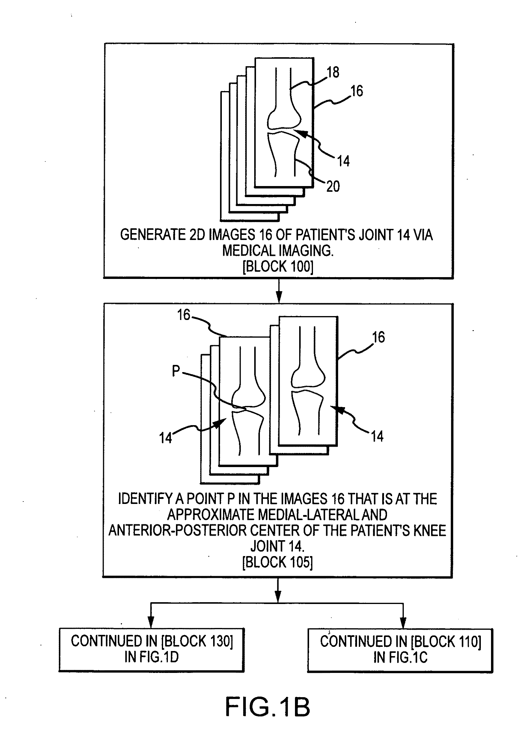 System and method for image segmentation in generating computer models of a joint to undergo arthroplasty