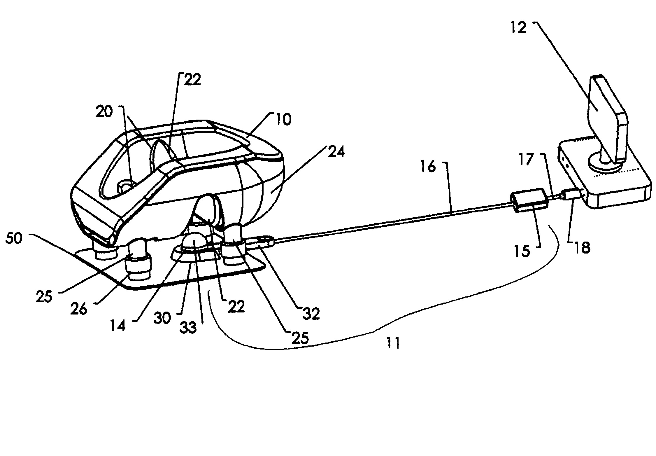 Video observation of a patient's face during a medical procedure while the patient is in a prone position