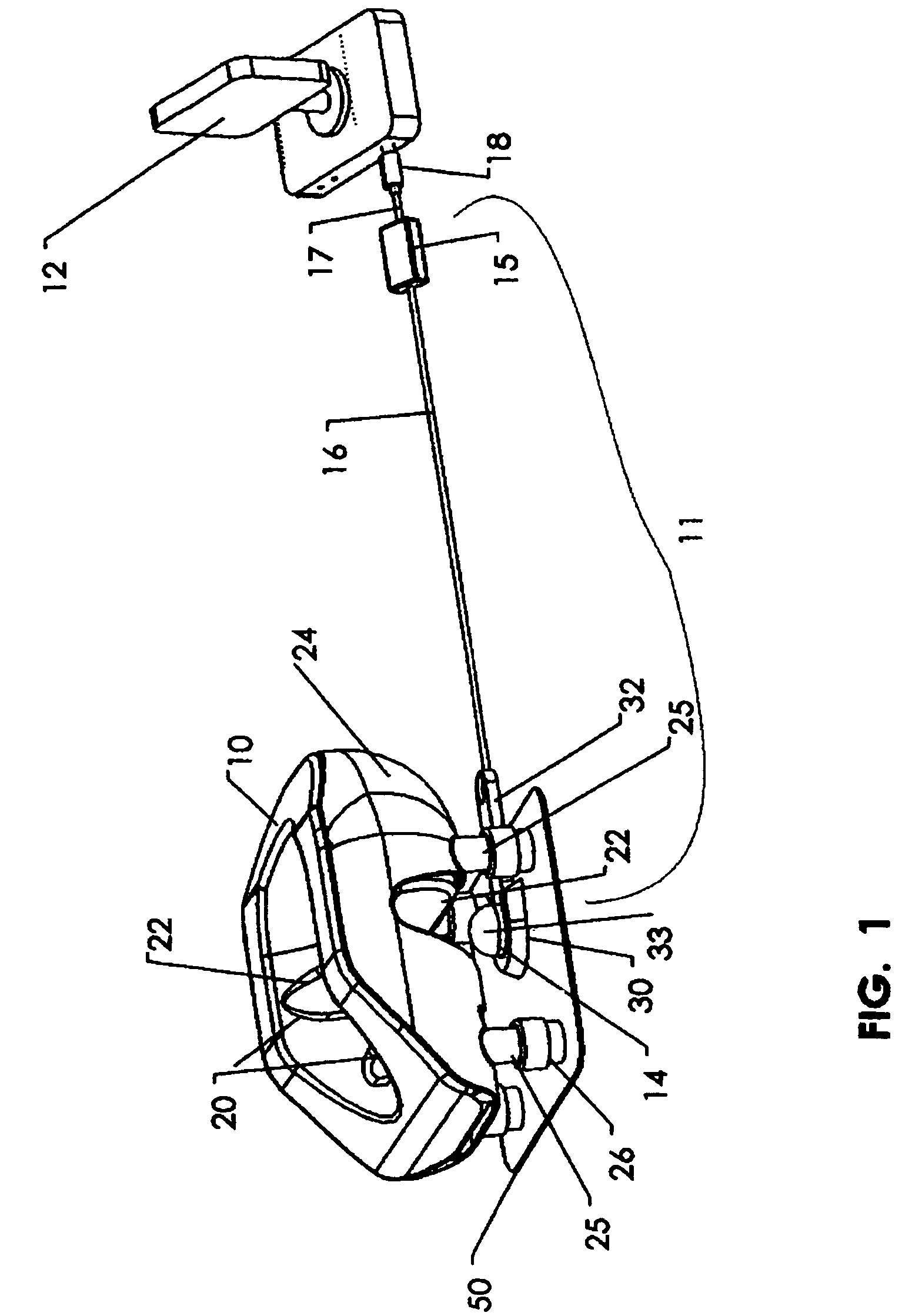 Video observation of a patient's face during a medical procedure while the patient is in a prone position