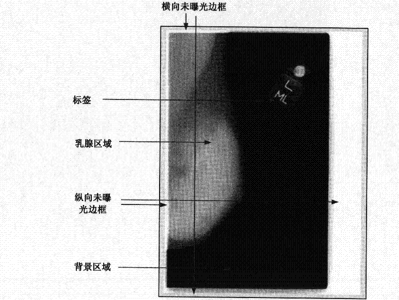 Preprocessing method for breast region extraction in breast molybdenum target X-ray image