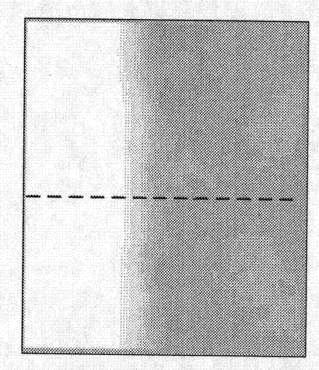 Preprocessing method for breast region extraction in breast molybdenum target X-ray image