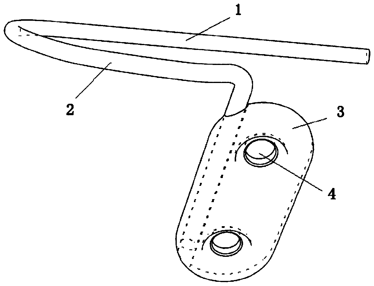 Internally implanted anatomical elbow joint stabilizer