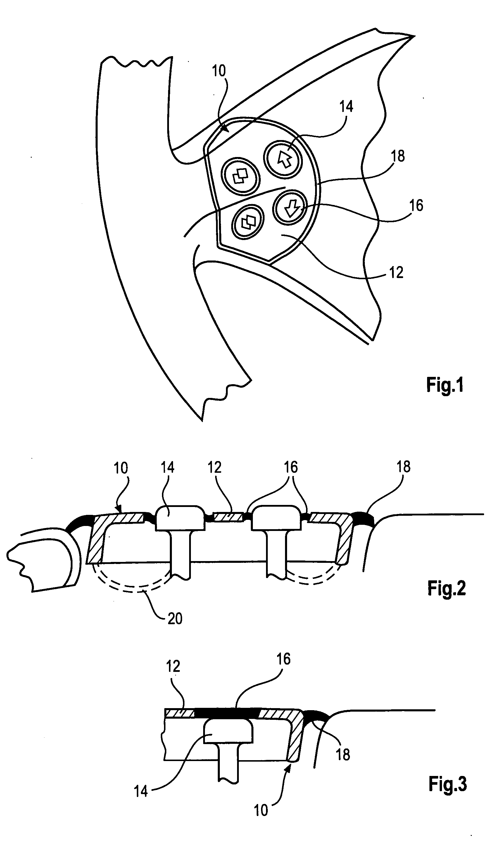 Partly chrome-plateable device and method of manufacturing the same
