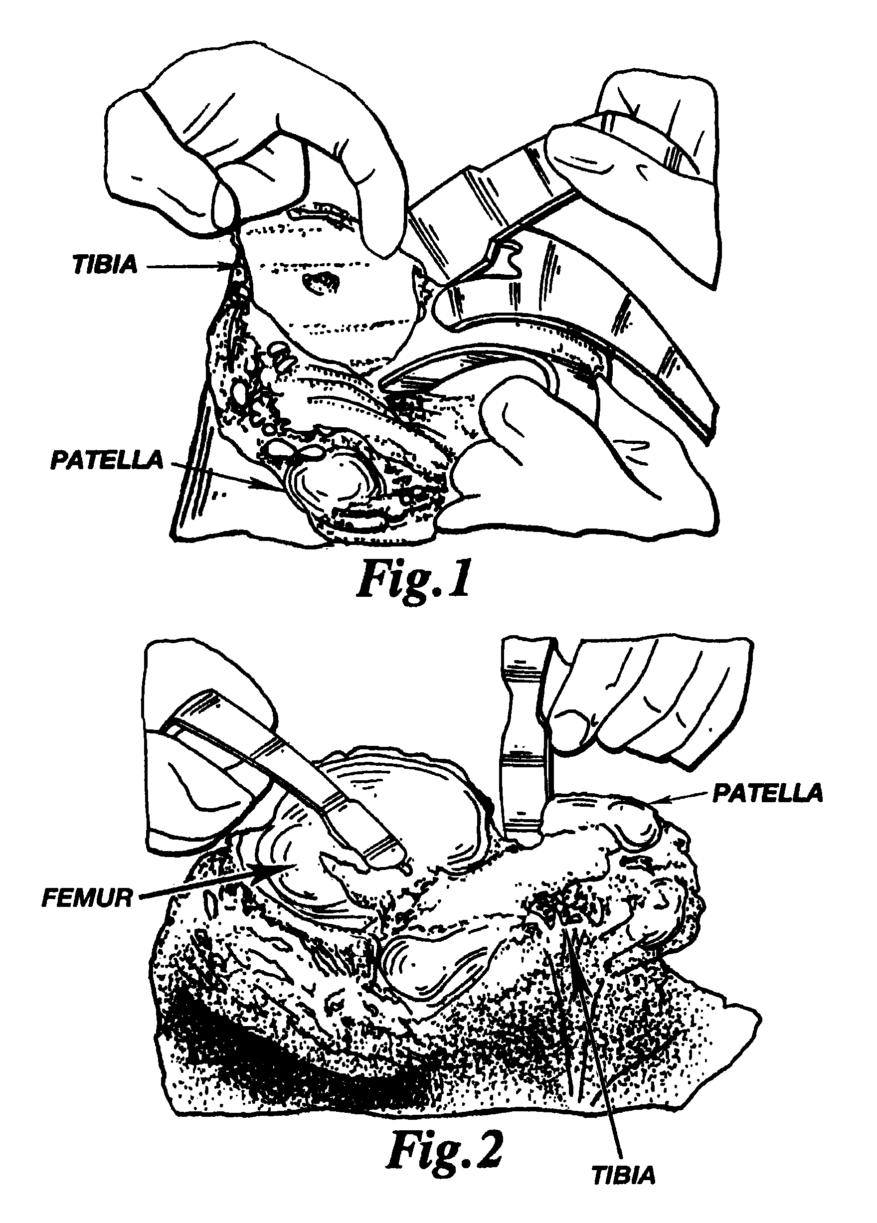 Methods and apparatus for improved drilling and milling tools for resection