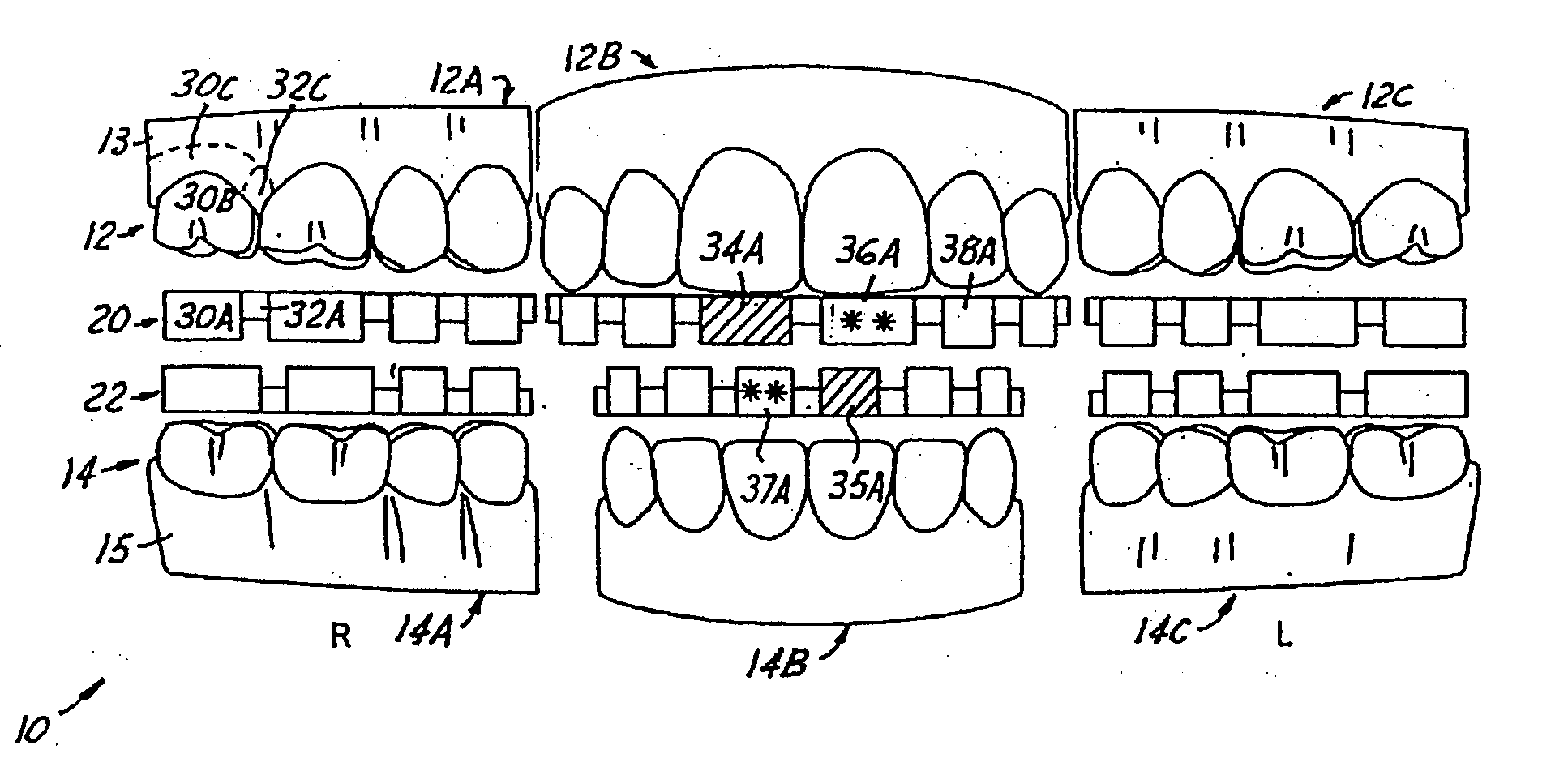Method and system for periodontal charting