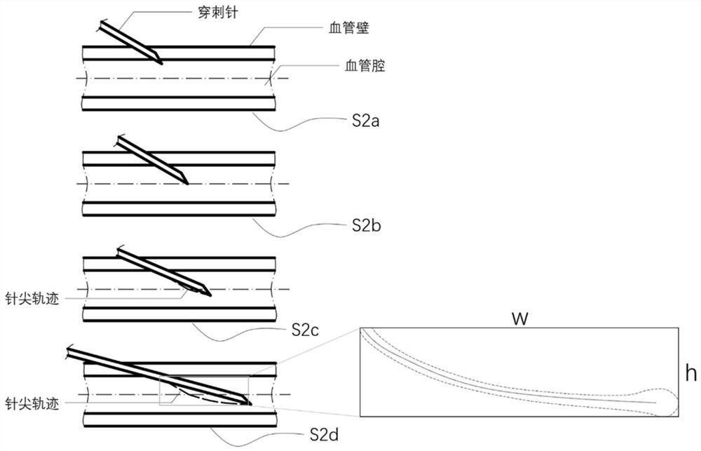 Ultrasound image-guided operation trajectory planning method for venipuncture robot