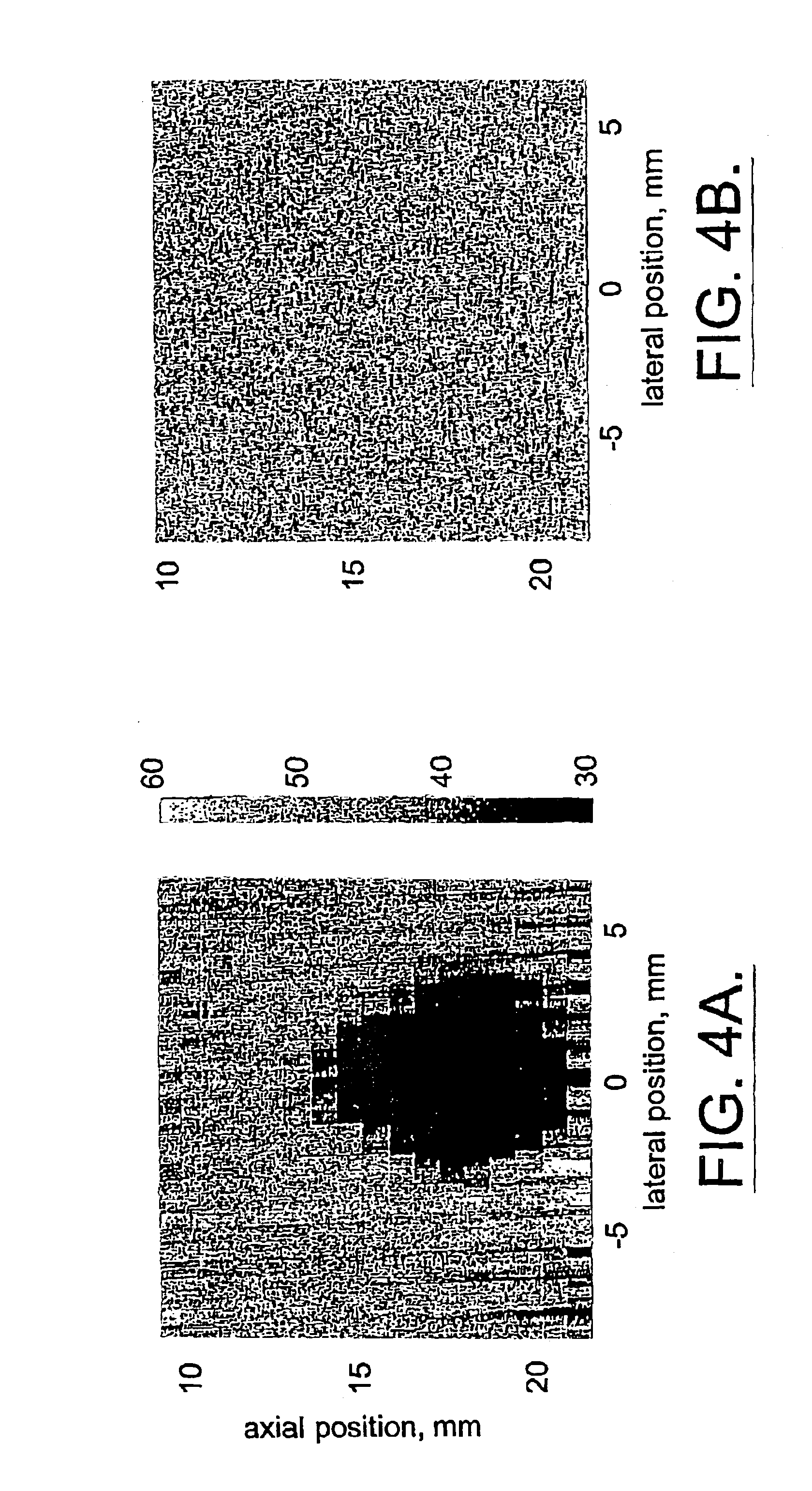 Method and apparatus for the identification and characterization of regions of altered stiffness