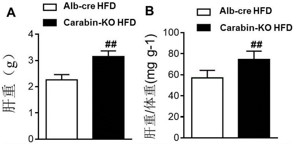 Function and application of Carabin in treatment of fatty liver and diabetes mellitus type 2