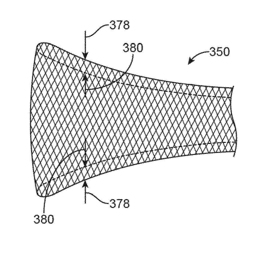 Retrieval systems and methods for use thereof