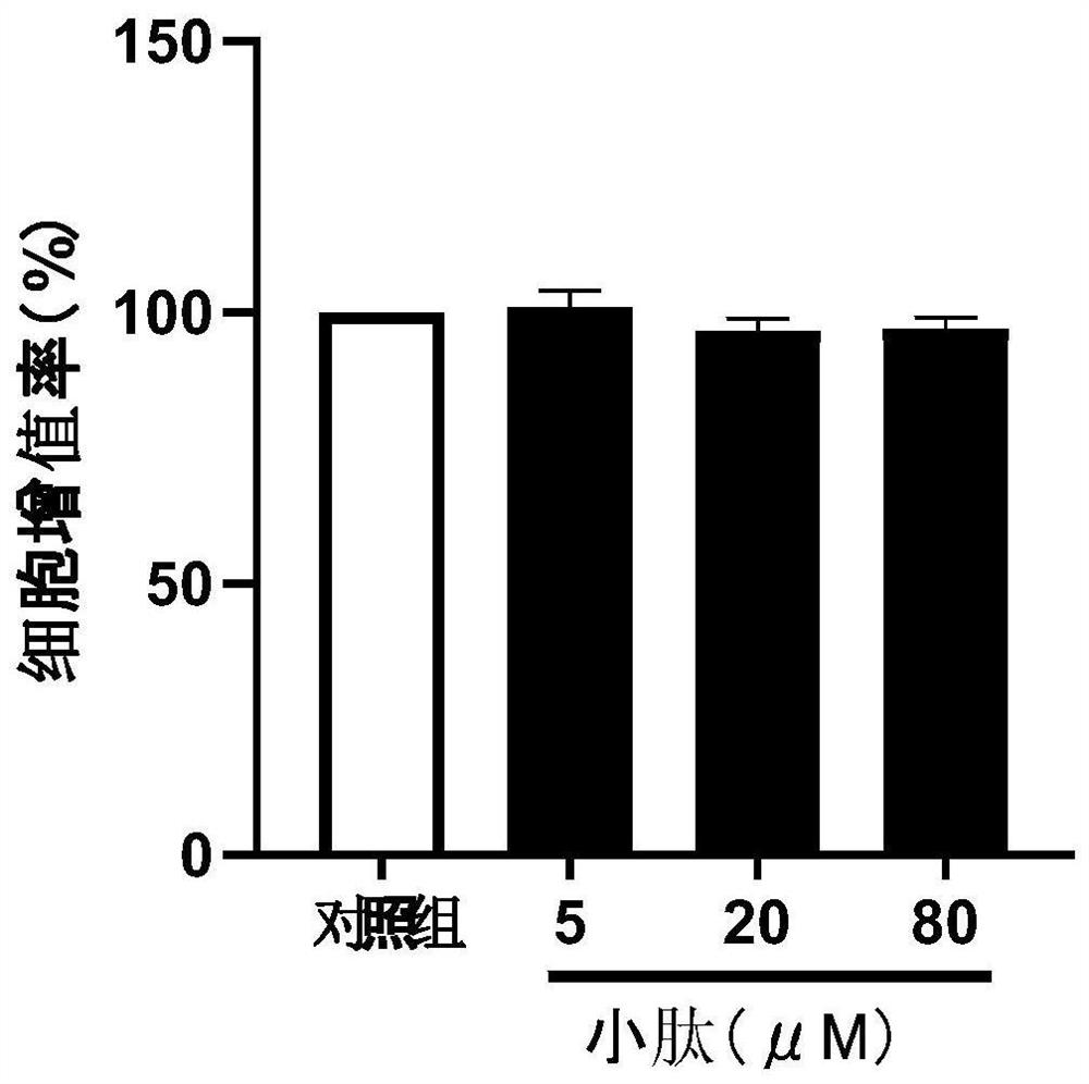 Small peptide with function of preventing and treating enteritis and application thereof