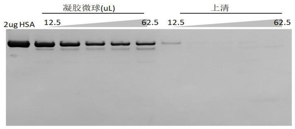 Human Serum Albumin Removal Kit