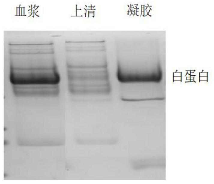 Human Serum Albumin Removal Kit