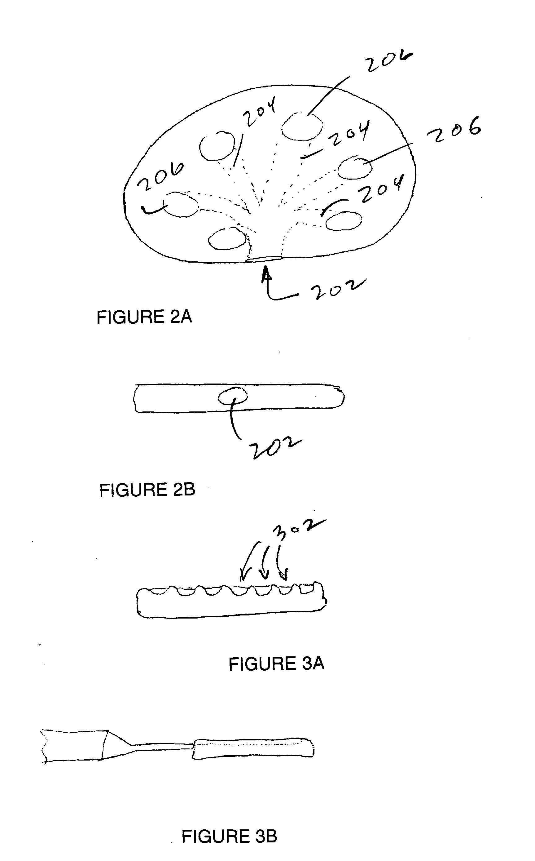 Cemented artificial disc replacements