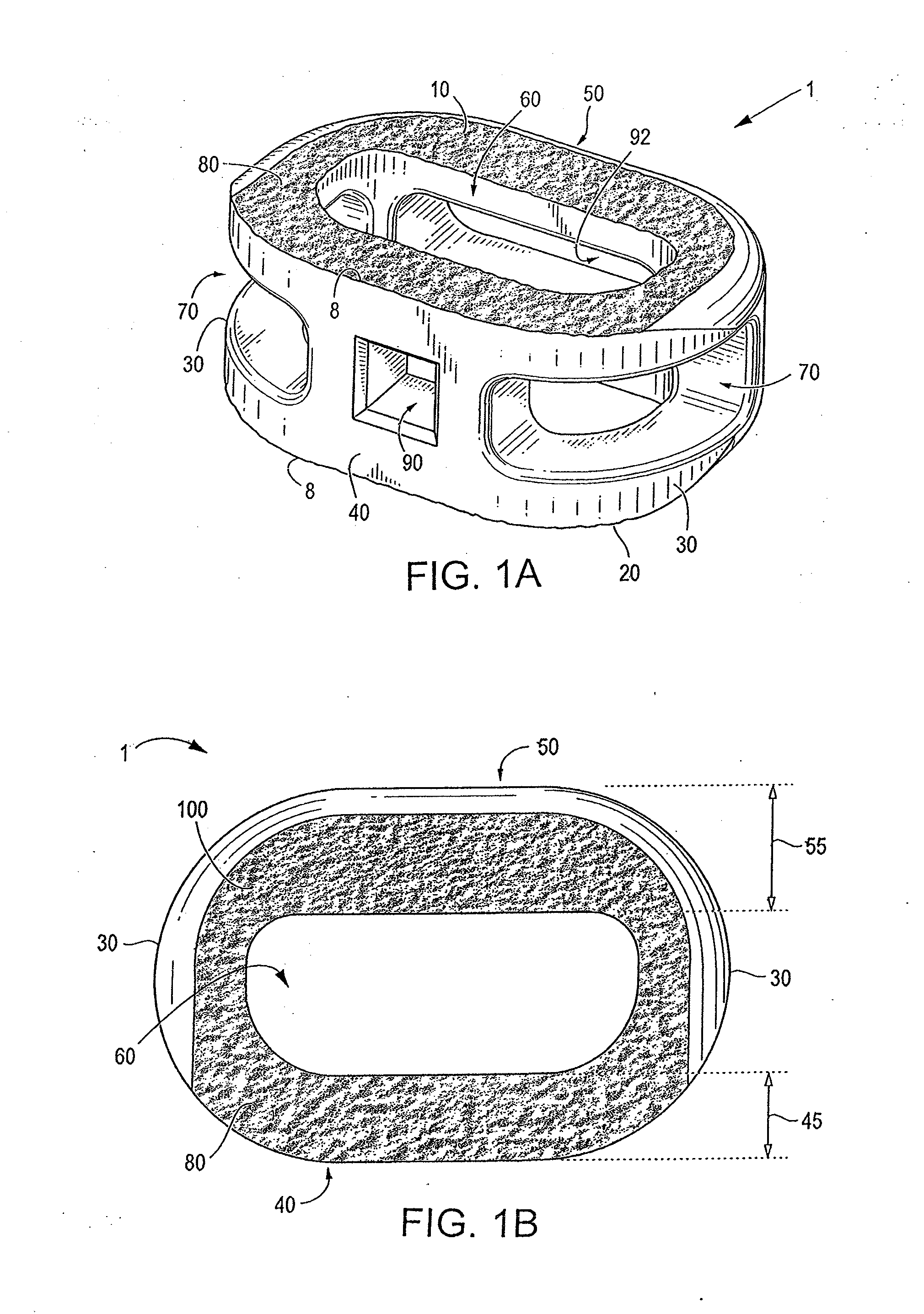 Endplate-preserving spinal implant having a raised expulsion-resistant edge