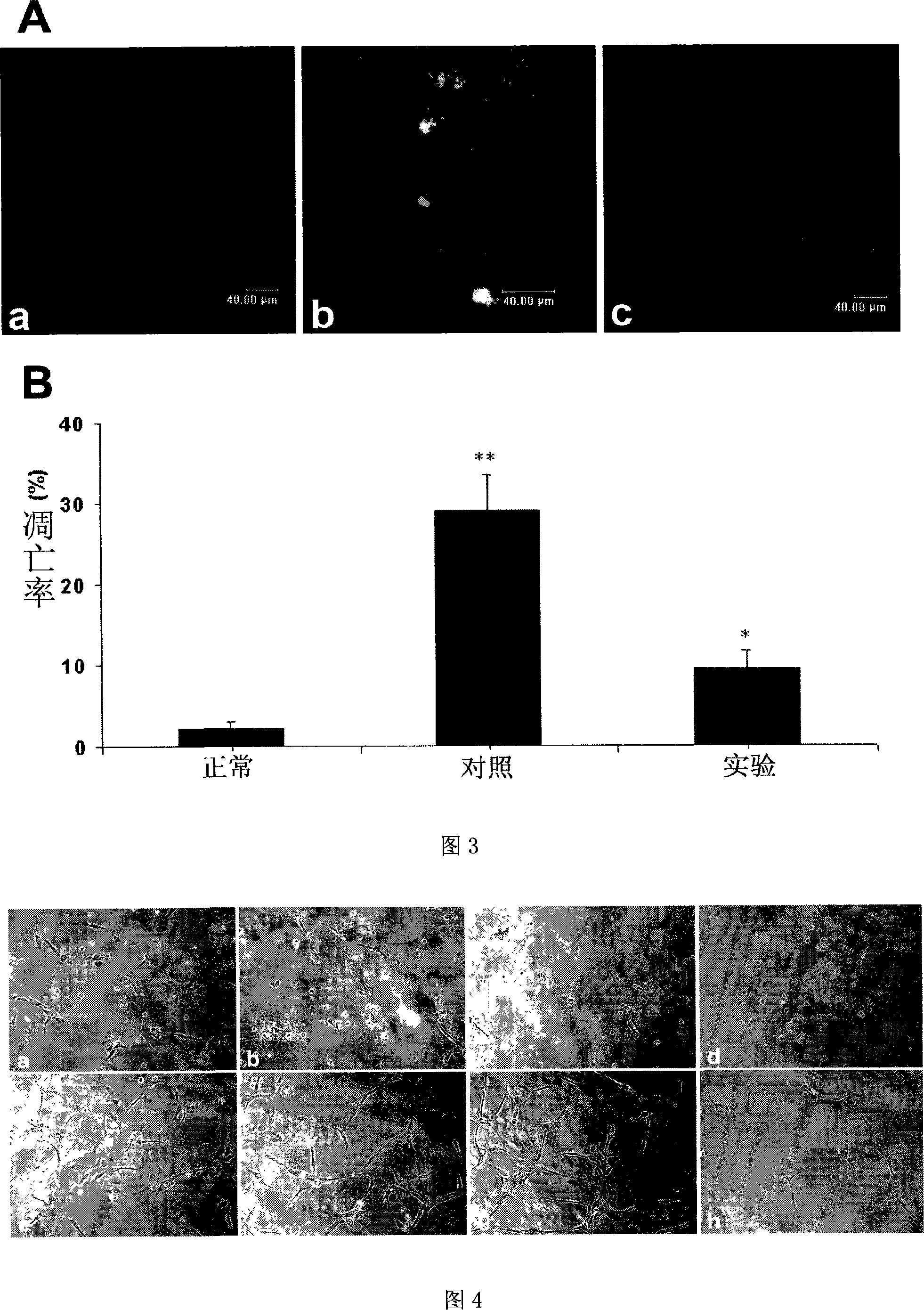 Application of 2,3 -dihydrogen-3 -hydroxymethyl- 6- amino- [1,4]- benzoxazine in preparing inhibition apoptosis of vascular endothelial cell and promoting neovascularization medicine