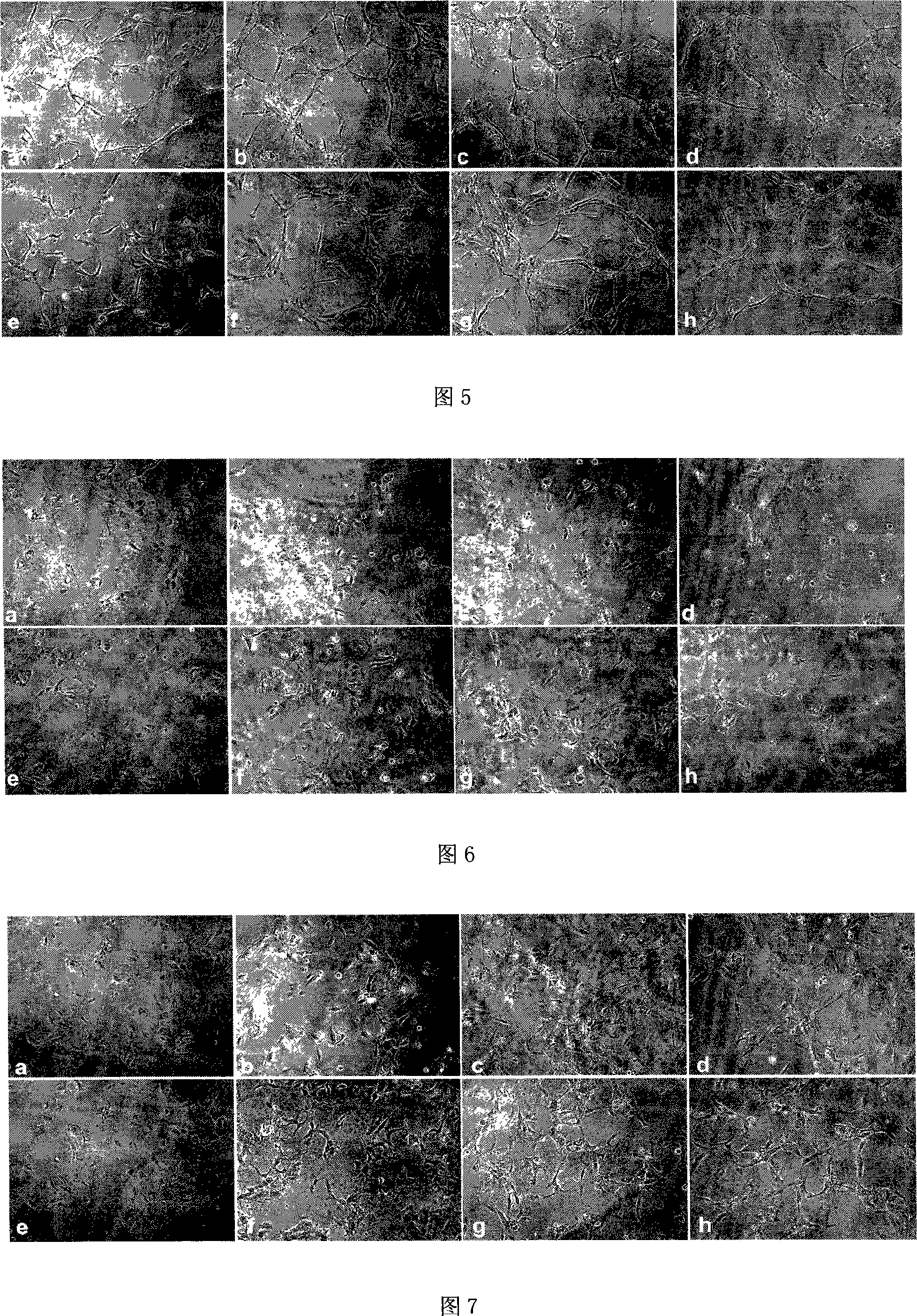 Application of 2,3 -dihydrogen-3 -hydroxymethyl- 6- amino- [1,4]- benzoxazine in preparing inhibition apoptosis of vascular endothelial cell and promoting neovascularization medicine