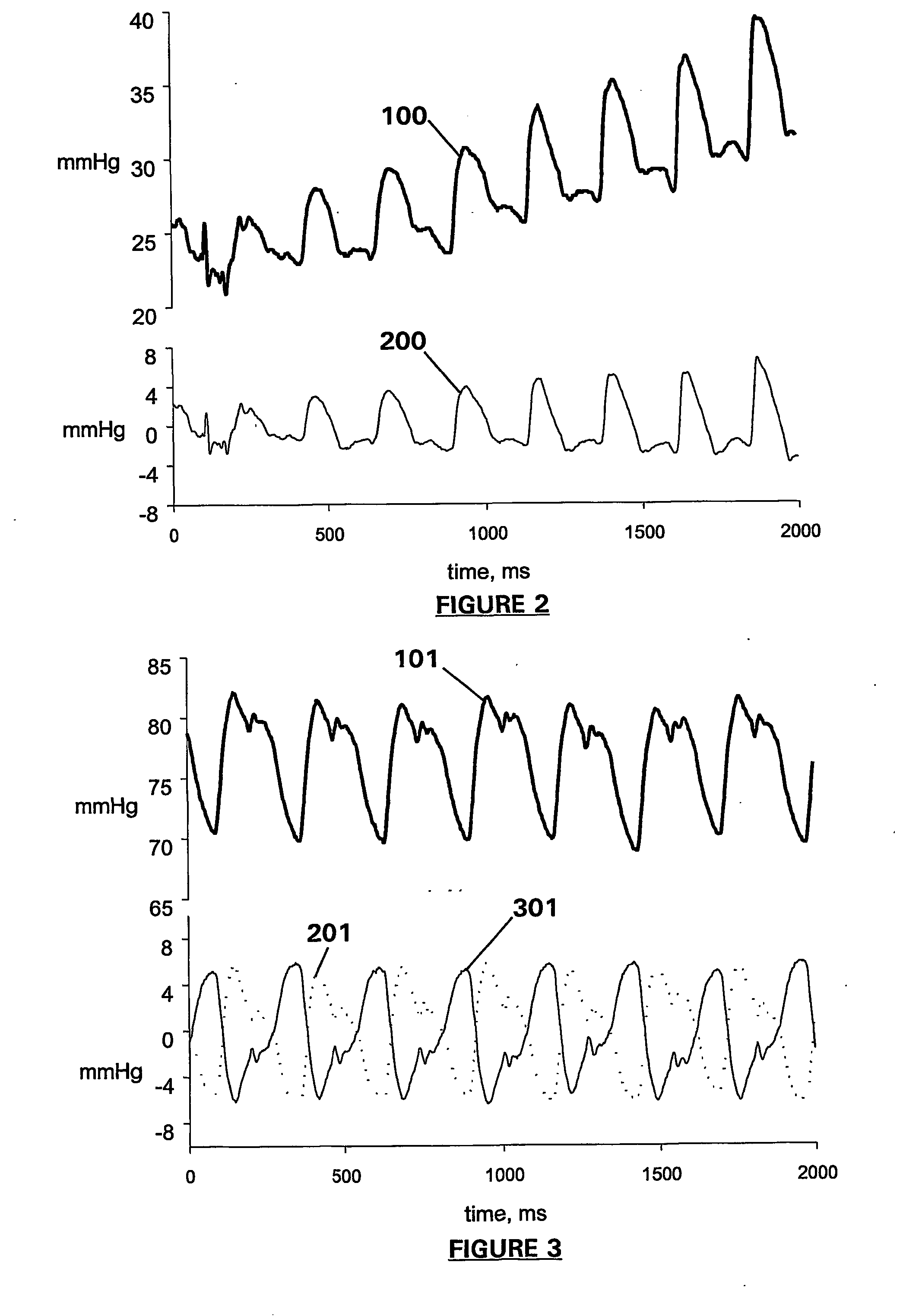 Apparatus and method for detection and quantification of oscillatory signals