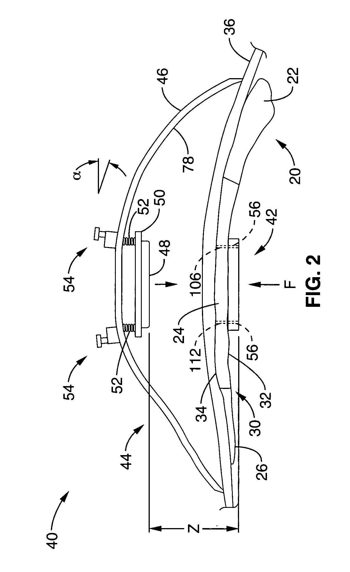 Apparatus and methods for magnetic alteration of anatomical features