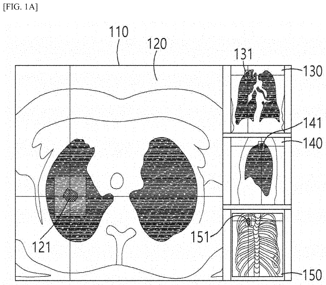 Method for aiding visualization of lesions in medical imagery and apparatus using the same